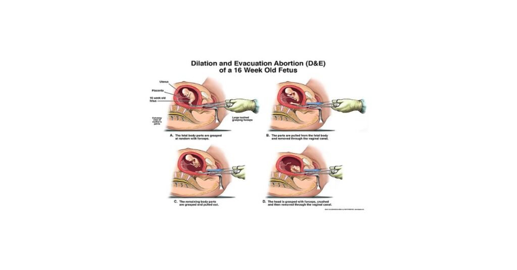 What Are Your Options? (Medical vs Surgical)